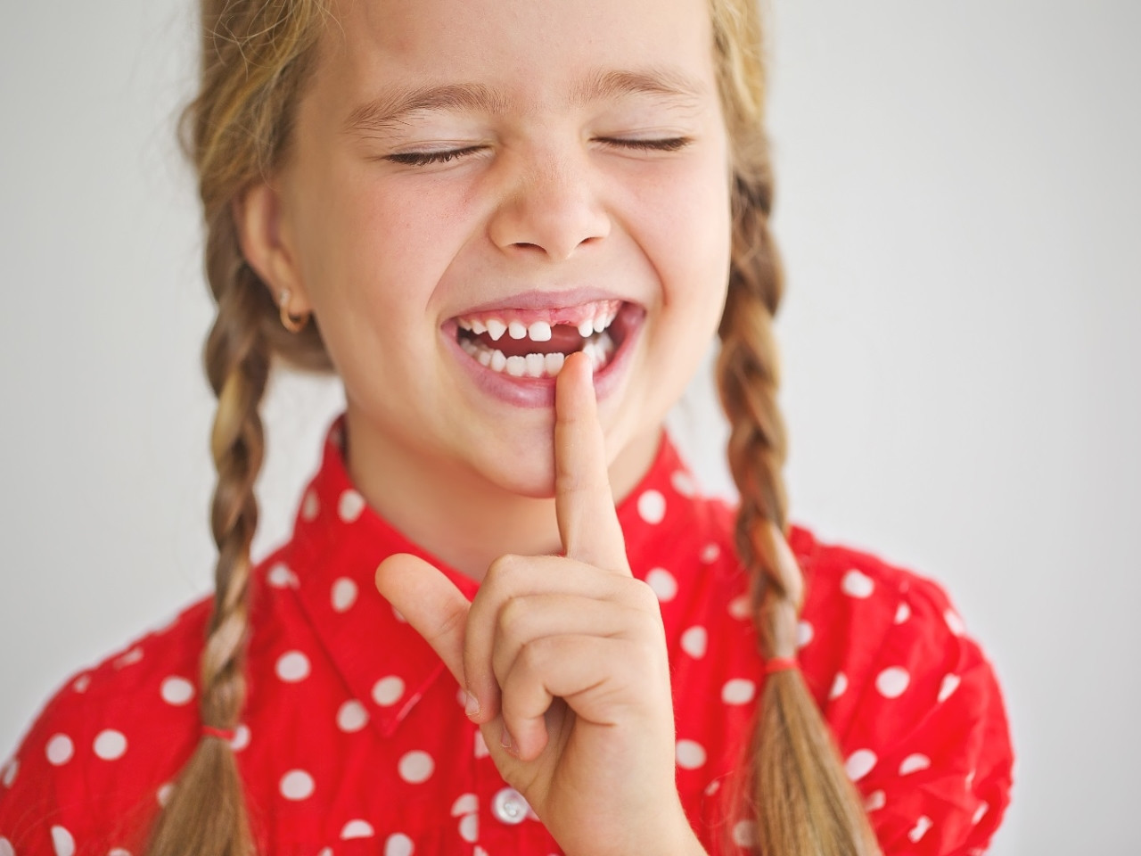 Denti da latte: Cosa fare se non cadono | Dentisti Trapani Di Maio Sorrento