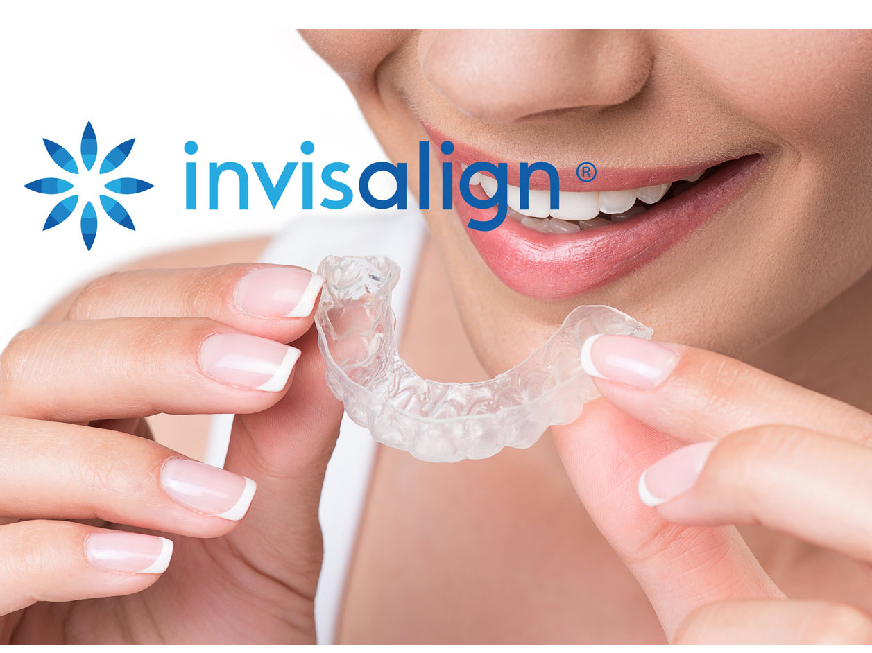 Invisalign Sorrento| Dentisti Trapani Di Maio Sorrento