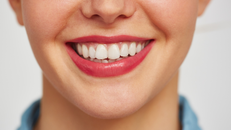 Come correggere il sorriso gengivale: cause, rimedi ed efficacia dei trattamenti