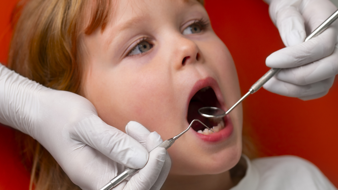 Affollamento dentale: cos’è e cosa comporta