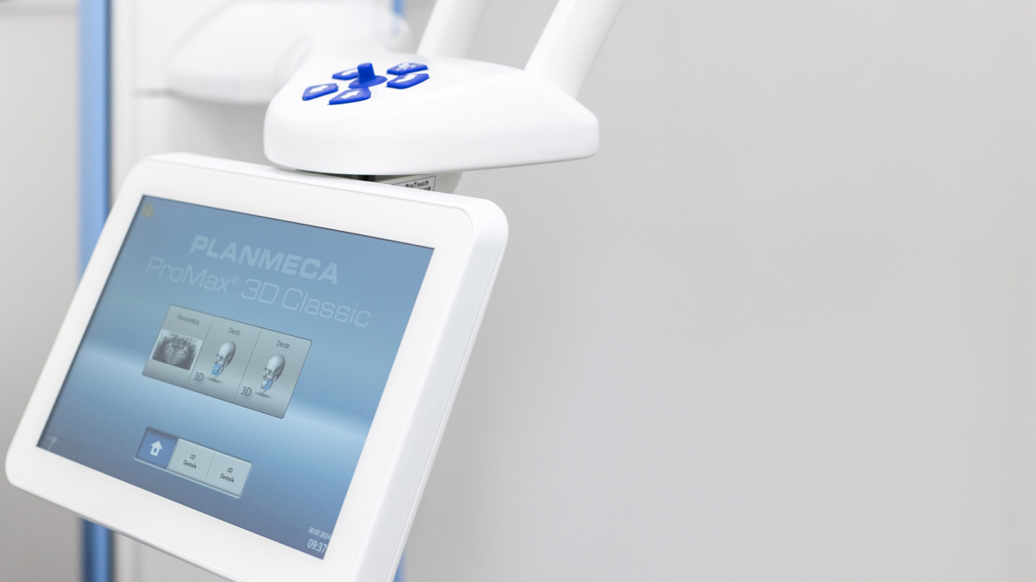 Tac dentale 3D a Sorrento: cos’è e come funziona